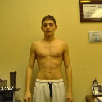 After Photo