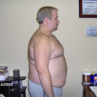 Before Photo