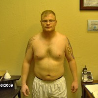 Before Photo