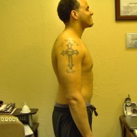 After Photo
