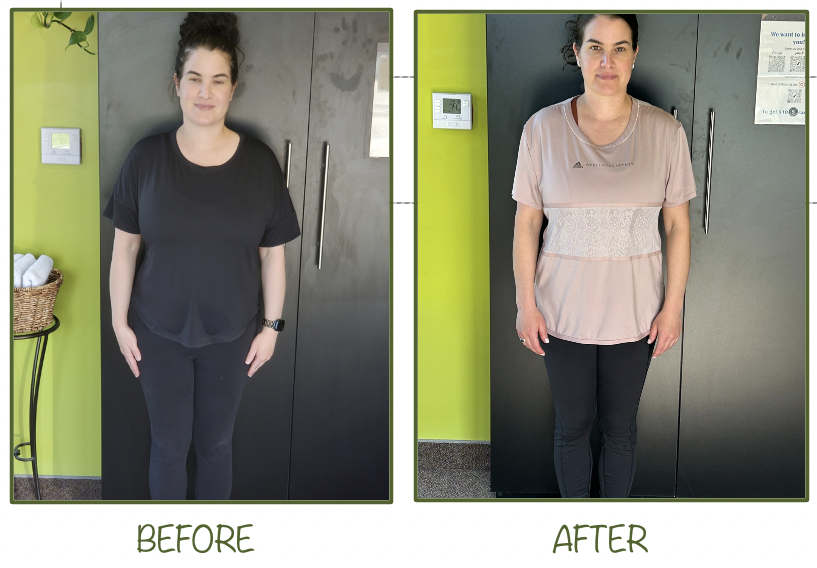 before and after of woman